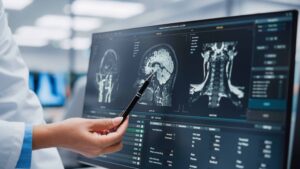 Doctor reviewing brain MRI scans on computer screen for neurological diagnosis