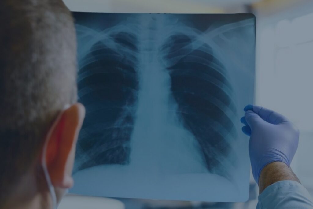 radiology error example