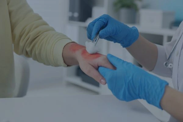 chemical burn being treated in hospital