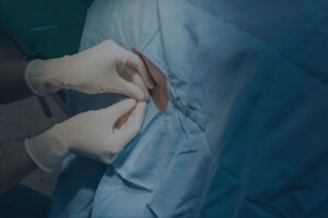 epidural negligence image